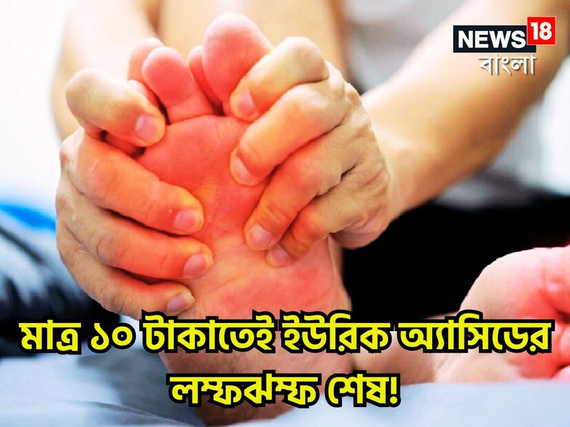 শরীরে ইউরিক অ্যাসিডের বাড়ন্ত হলেই নানান ধরনের সমস্যা হতে দেখতে পাওয়া যায় ৷ এমন হলে খাদ্যাভাসে কিছু পরিবর্তন আনতে হবে ৷ প্রতীকী ছবি ৷ শরীরে ইউরিক অ্যাসিডের বাড়ন্ত হলেই নানান ধরনের সমস্যা হতে দেখতে পাওয়া যায় ৷ এমন হলে খাদ্যাভাসে কিছু পরিবর্তন আনতে হবে ৷ প্রতীকী ছবি ৷