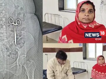 দুই বছর ধরে পেটে নরকের যন্ত্রণা, সিটি স্ক্যানে ধরা পড়ল কারণ, অবাক ডাক্তাররা!