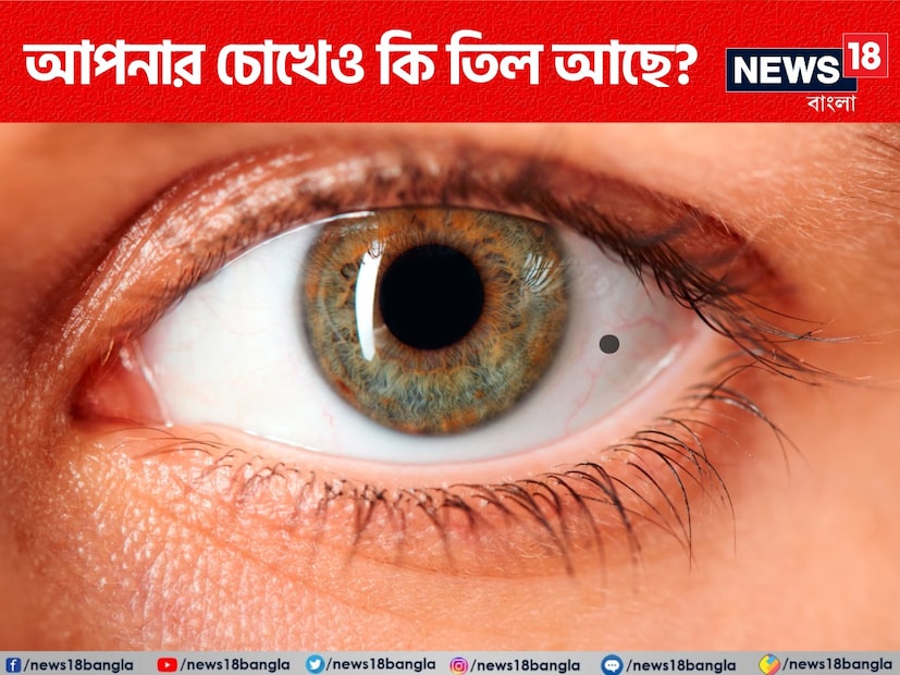 ভূপালের জ্যোতিষী এবং বাস্তু পরামর্শদাতা পন্ডিত হিতেন্দ্র কুমার শর্মা এ বিষয়ে কী বলেছেন জেনে নেওয়া যাক। সামুদ্রিক শাস্ত্রের স্মরণ করিয়ে হিতেন্দ্র জানান, চোখের ভিতরে তিল থাকা আসলে সৌভাগ্যেরই লক্ষ্মণ। 