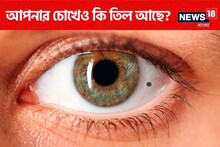 চোখের ভিতরে এরকম 'তিল' আছে আপনারও? কিসের লক্ষণ? জানলে চমকাবেন!
