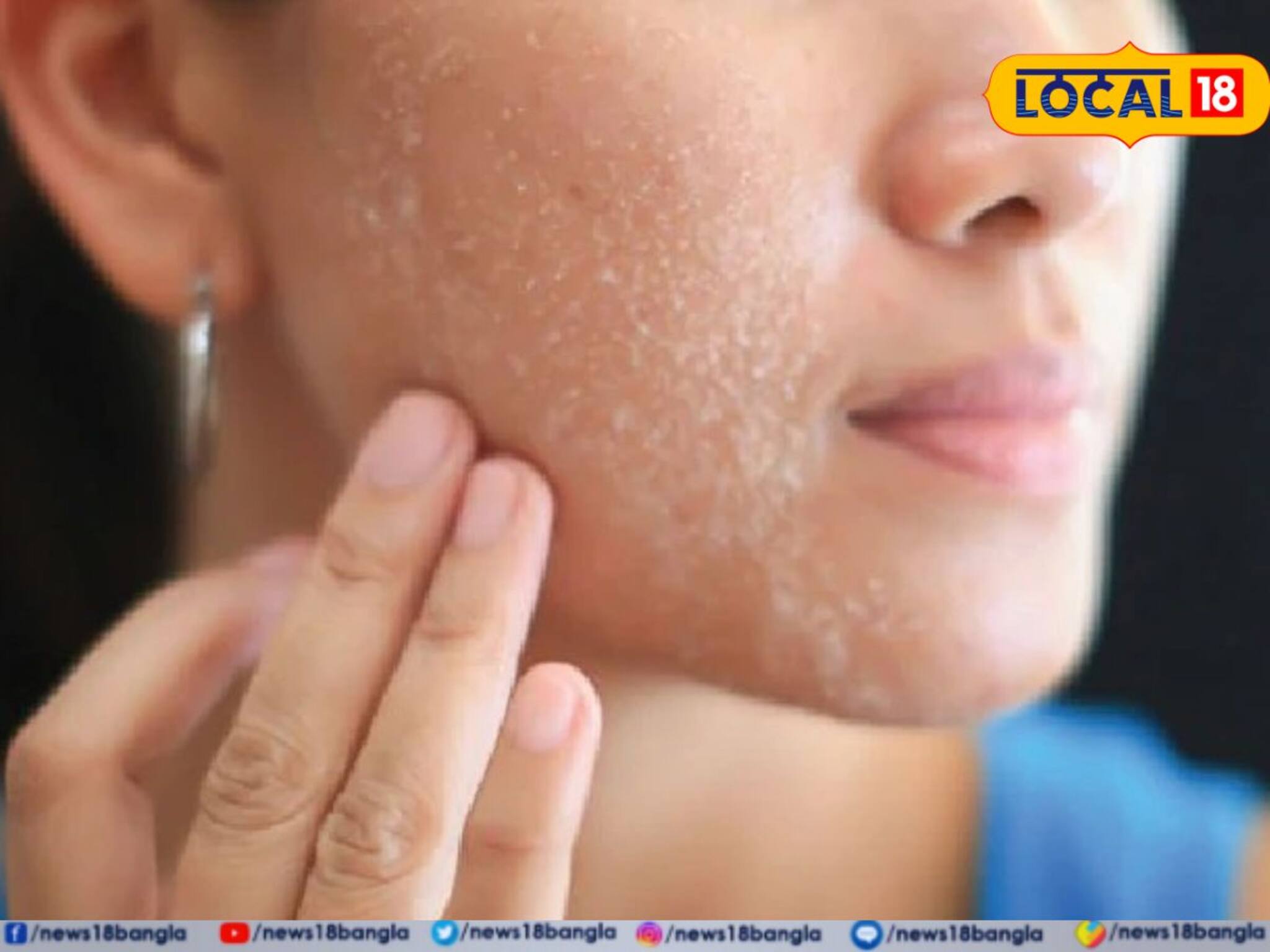 নামী-দামি ক্রিম মেখেও ত্বক শুকিয়ে কাঠ? এই এক কাজে হবে নরম-তুলতুলে-উজ্জ্বল! জানুন