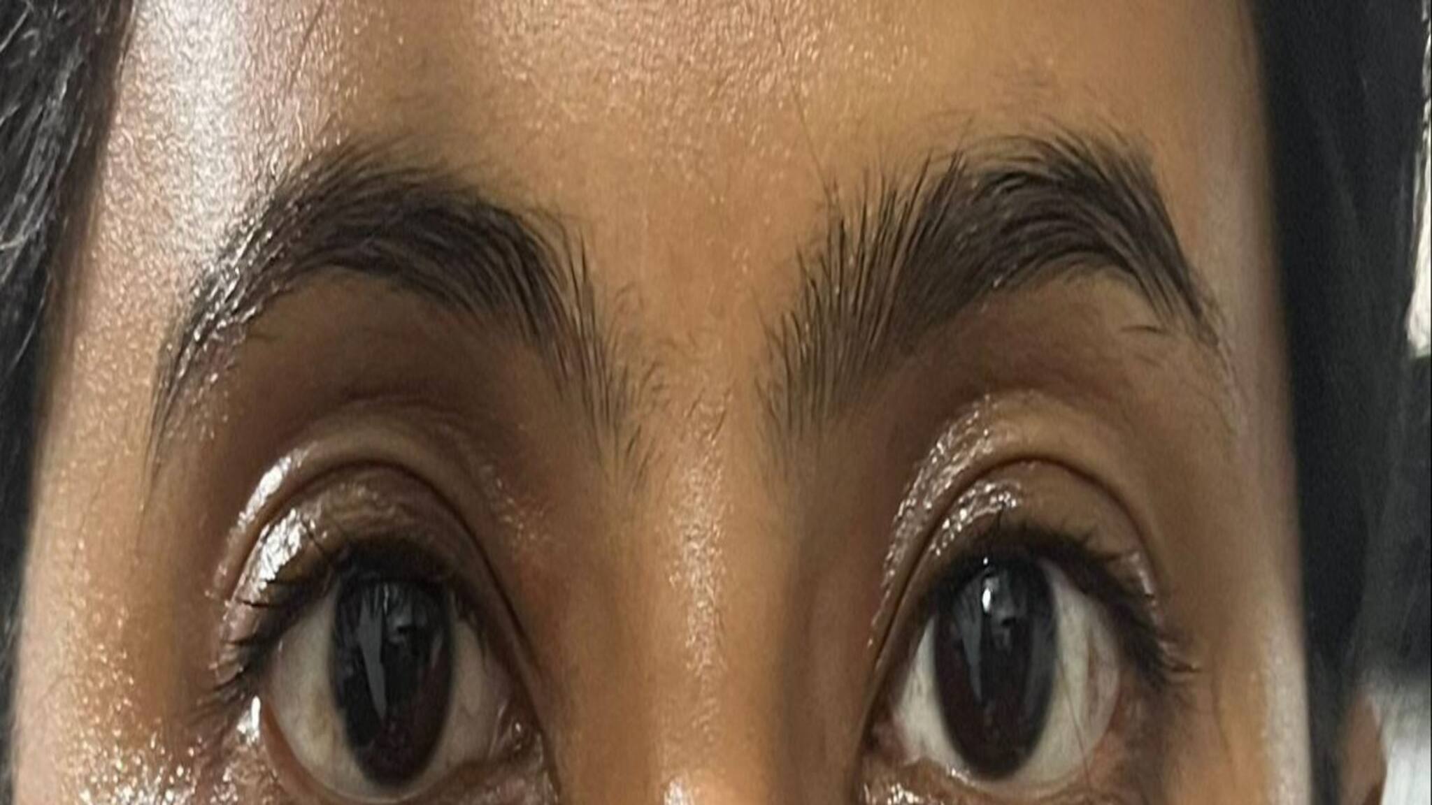 উধাও হবে ডার্ক সার্কেল..! ছোট্ট টোটকা করবে কামাল, চাঁদের মতো ঝকঝক করবে মুখ!