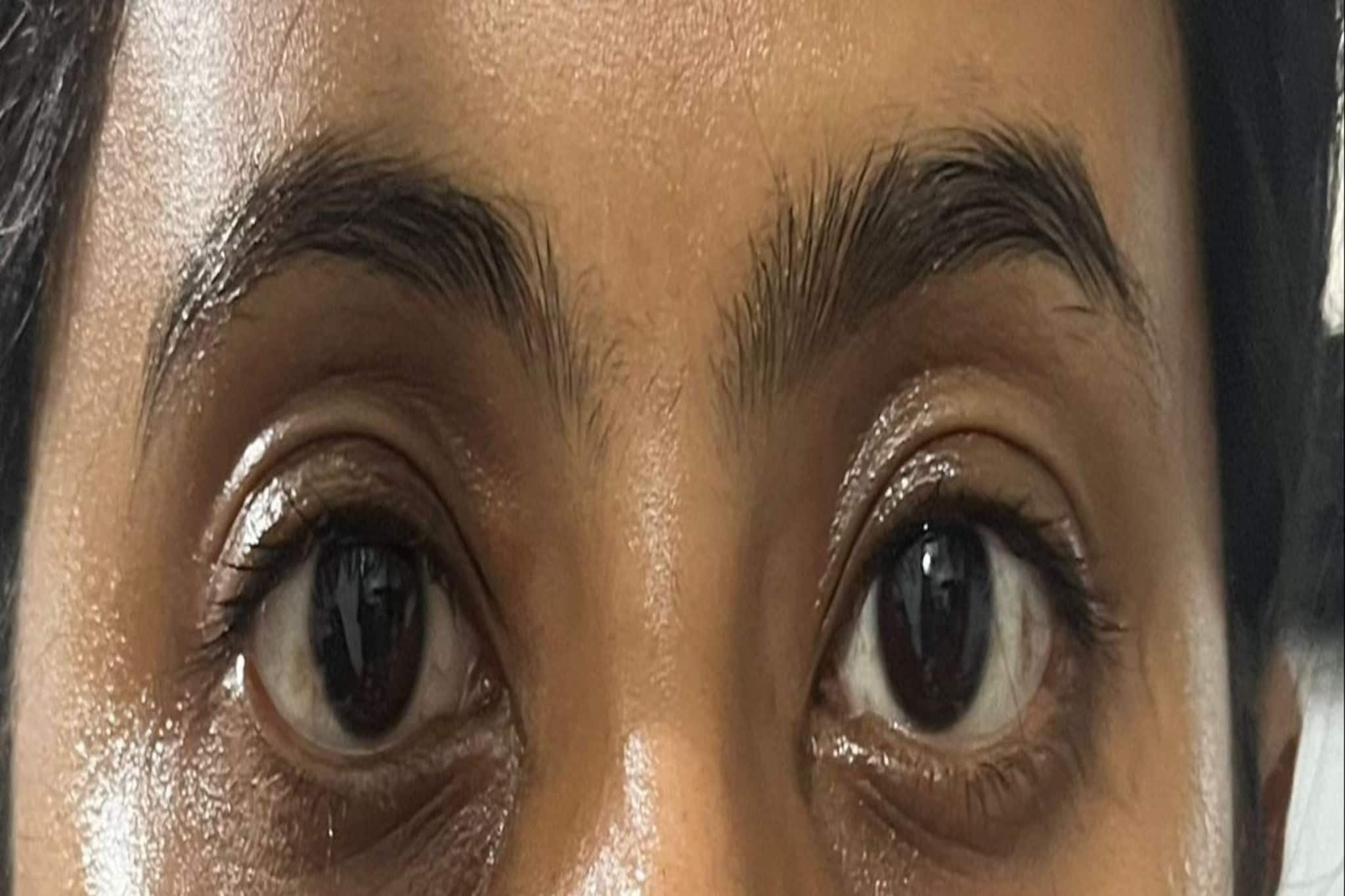 উধাও হবে ডার্ক সার্কেল..! ছোট্ট টোটকা করবে কামাল, চাঁদের মতো ঝকঝক করবে মুখ!