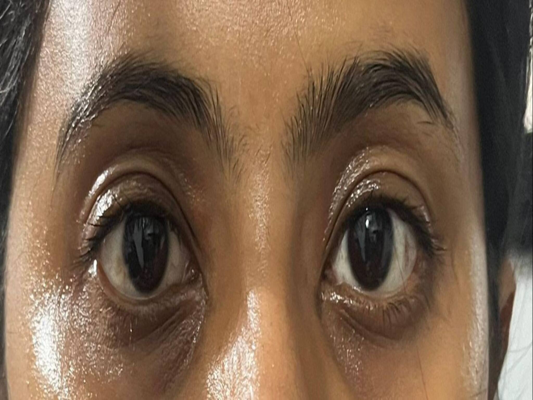 উধাও হবে ডার্ক সার্কেল..! ছোট্ট টোটকা করবে কামাল, চাঁদের মতো ঝকঝক করবে মুখ!