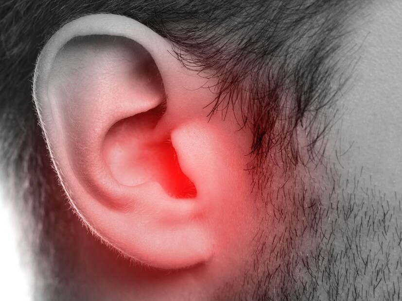 আদা থেঁতো করে রস বের করে কানে ঢেলে দিন। সংক্রমণ কমবে। আরাম পাবেন। অথবা দুই টেবিল চামচ অলিভ তেলের সঙ্গে এক চা চামচ আদার রস মিশিয়ে পাঁচ থেকে ১০ মিনিট রাখুন। এই তেল কানে দিন।  এই কিছু কিছু টিপস মেনে চললেই কানের ব্যথা থেকে রেহাই পাবেন আপনি। (তথ্য - পিয়া গুপ্তা) 