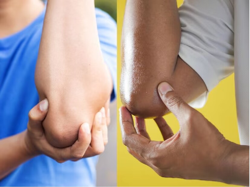 সায়েন্স এবিসি অনুসারে, এটি আলনার (ulnar nerve) স্নায়ুর কারণে ঘটে যাকে funny bone বা মজার হাড় বলা হয়। এটি মজার, কারণ এটি বৈদ্যুতিক শকের একটি নকল সংকেত দেয়। এটি ঘাড় থেকে শুরু হয় এবং আঙুল পর্যন্ত সঞ্চারিত হয়। এই স্নায়ুটির নামকরণ করা হয়েছে হাড়ের নামানুসারে যা বাহুর নীচের অংশে থাকে এবং এর প্রসারিত স্ফীতিটি কনুই হিসাবে কাজ করে। 