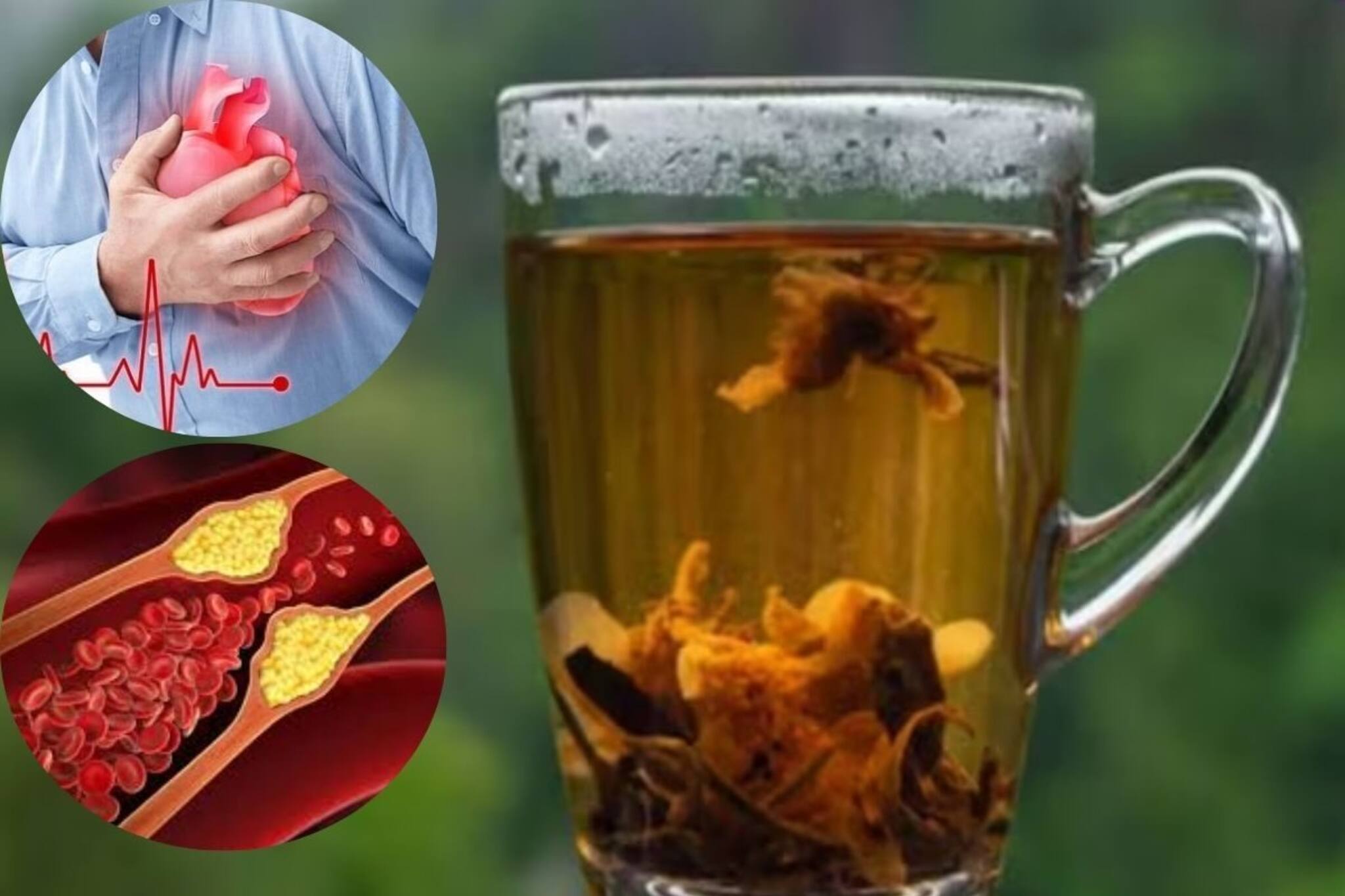 হার্ট অ‍্যাটাক থেকে বাঁচাবে এই ‘চা’! শিরায় জমা কোলেস্টেরলকে গলিয়ে বের করে দেবে