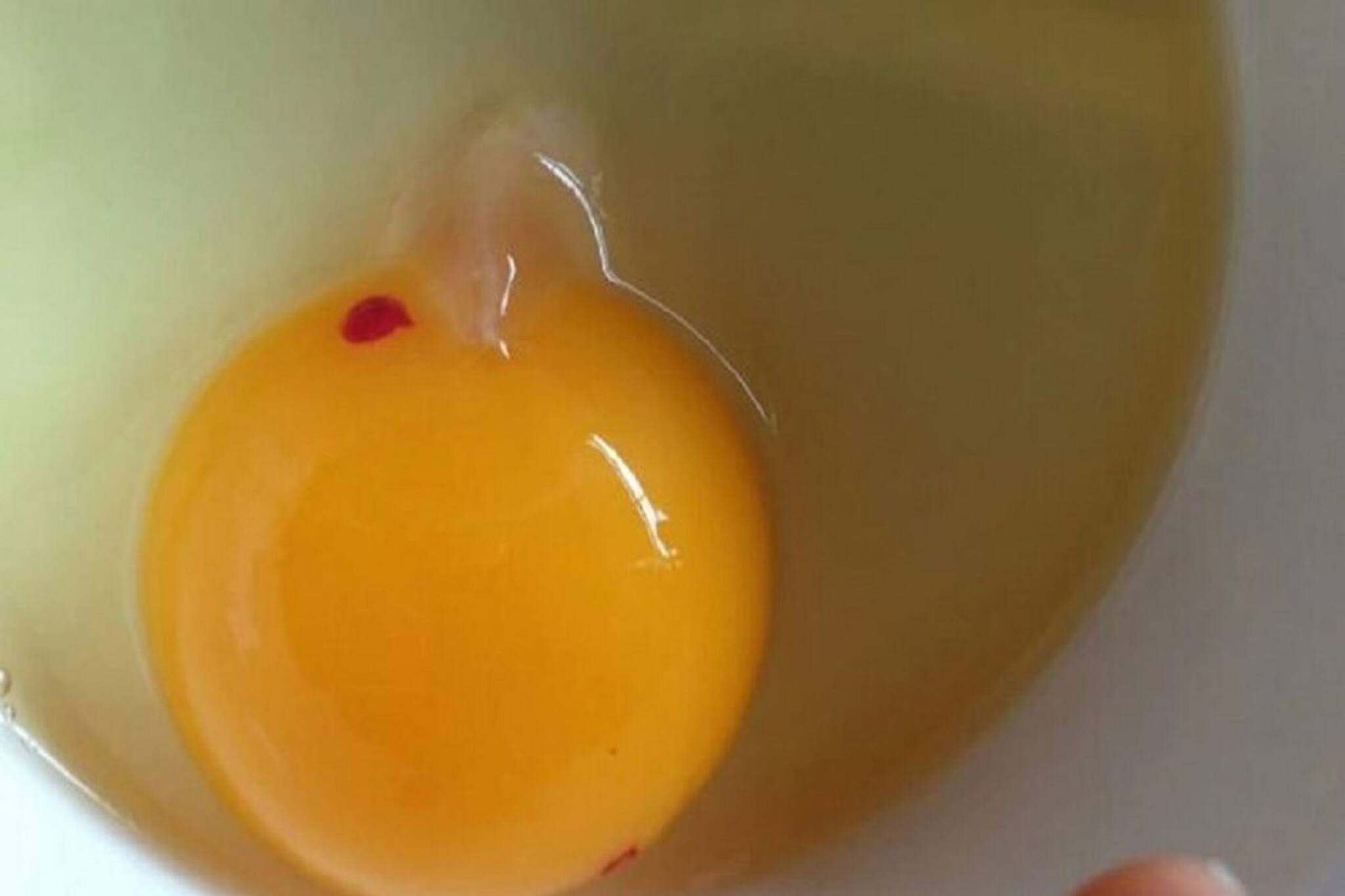 কুসুমে রক্তের দাগ খেয়াল করেছেন কখনও? এমন ডিম খেয়ে ফেললে শরীরে কী হয় জানেন?