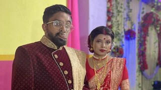 বিকৃত মুখ নিয়ে জন্ম