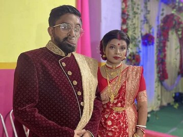 বিকৃত মুখ নিয়ে জন্ম