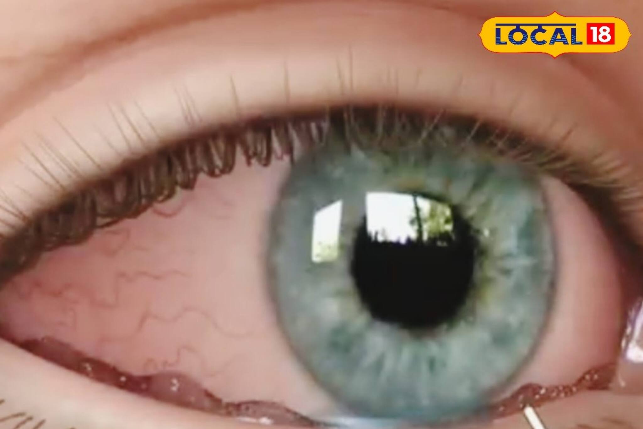 জবাফুলের মতো লাল চোখ? অসহ্য যন্ত্রণা, জল পড়ছে? কনজাংটিভাইটিসে আক্রান্ত হননি তো?