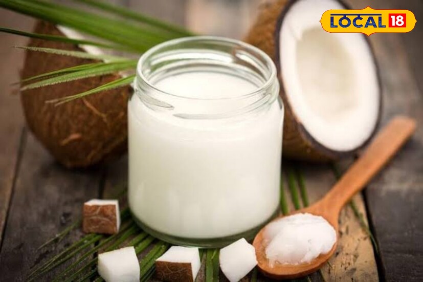  ত্বকের দাগ এবং অ্যাকনে কমাতে সাহায্য করে: নারকেল তেলে আছে অ্যান্টি-ব্যাকটেরিয়াল এবং অ্যান্টি-ফাঙ্গাল গুণ। এটি ত্বকের ইনফেকশন এবং অ্যাকনের বিরুদ্ধে লড়াই করে। ত্বকের দাগ এবং ফুসকুড়ি কমাতে এটি খুবই কার্যকর। photo source collected 