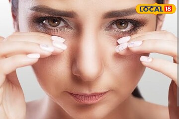 চোখের পাতা লাফাচ্ছে? শুভ-অশুভ নয়, শরীরে বাসা বেঁধেছে জটিল রোগ! জানুন চোখের পাতা লাফাচ্ছে? শুভ-অশুভ নয়, শরীরে বাসা বেঁধেছে জটিল রোগ! জানুন