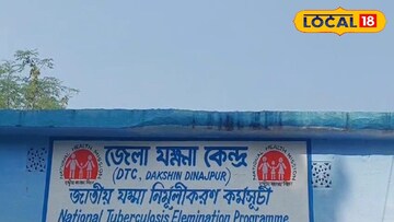 যক্ষ্মা