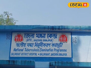 যক্ষ্মা