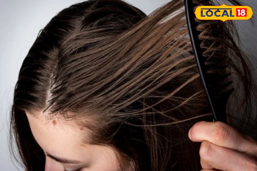 চুলের যত্নে শীতকালে কিছু মাস্ক ব্যবহার করতে পারেন। চুল পড়া রোধে নারকেল তেল ও ক্যাস্টর অয়েলের সঙ্গে ভিটামিন সি ক্যাপসুল ও ডিমের কুসুম মিশিয়ে মাথায় লাগালে চুলের উপকার হয়। আবার চুলে মসৃণ ও চকচকে ভাব আনার জন্য মধু, টকদই ও ডিমের সাদা অংশ একসঙ্গে মিশিয়ে প্যাক বানিয়ে ব্যবহার করতে পারেন