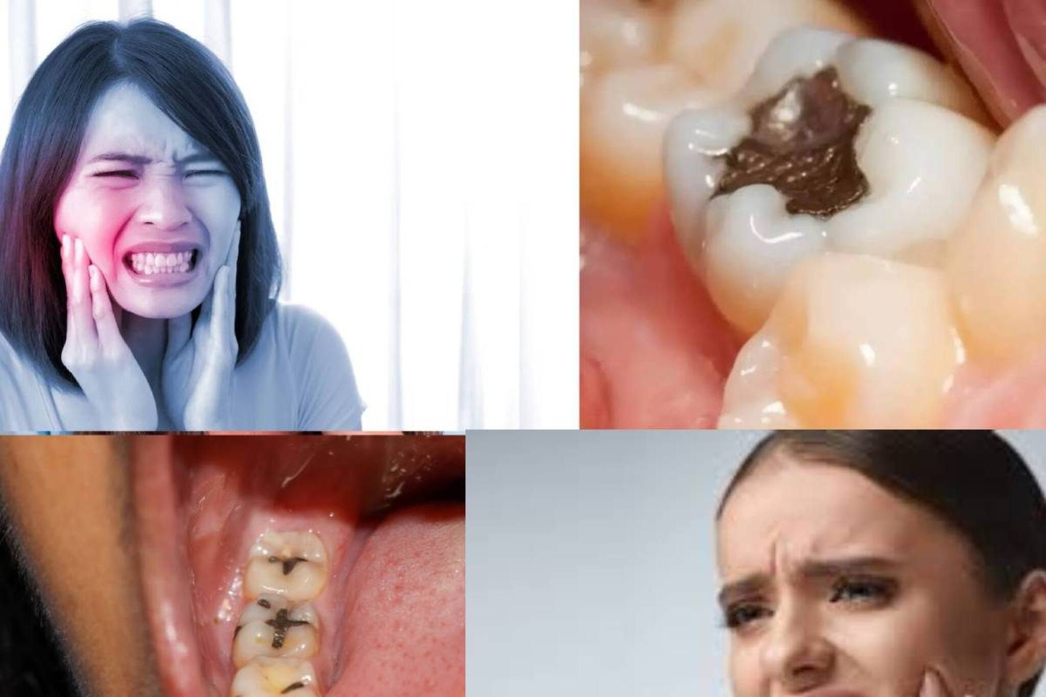 কোন ভিটামিনের অভাবে দাঁতে গর্ত করে ‘পোকা’? কী খেলে পোকা হবে না দাঁতে? জানুন