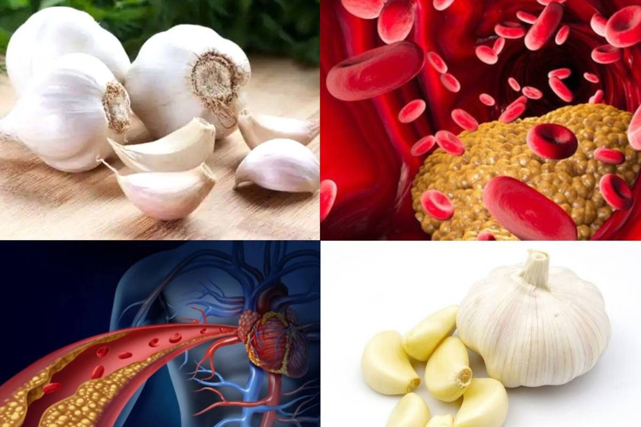 জাস্ট ২ কোয়া রসুনেই জব্দ কোলেস্টেরল! সুস্থ হার্ট! শুধু এ সময়ে খান এই ভাবে