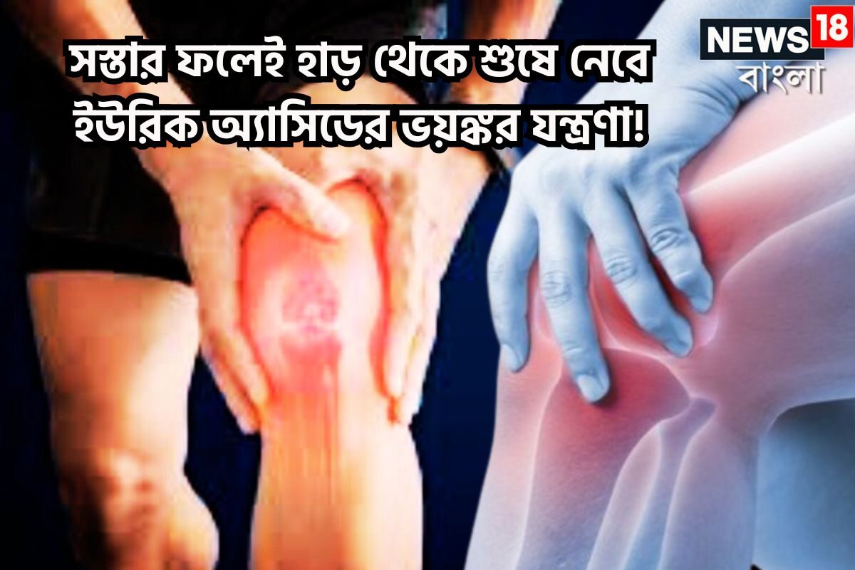 মাত্র ৫ টাকার ফলেই কোণঠাসা ইউরিক অ্যাসিড! মুহূর্তেই ভ্যানিশ ব্যথা-যন্ত্রণা