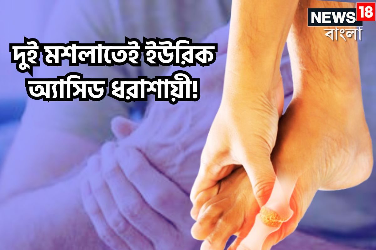 রান্নাঘরের দুই মশলাতেই ভয়ঙ্কর যন্ত্রণা শেষ! ইউরিক অ্যাসিড মূল থেকে উপড়ে ফেলবে