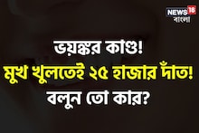GK: ভয়ঙ্কর কাণ্ড! মুখ খুলতেই বেরিয়ে এল ২৫ হাজার দাঁত, বলুন তো কার?