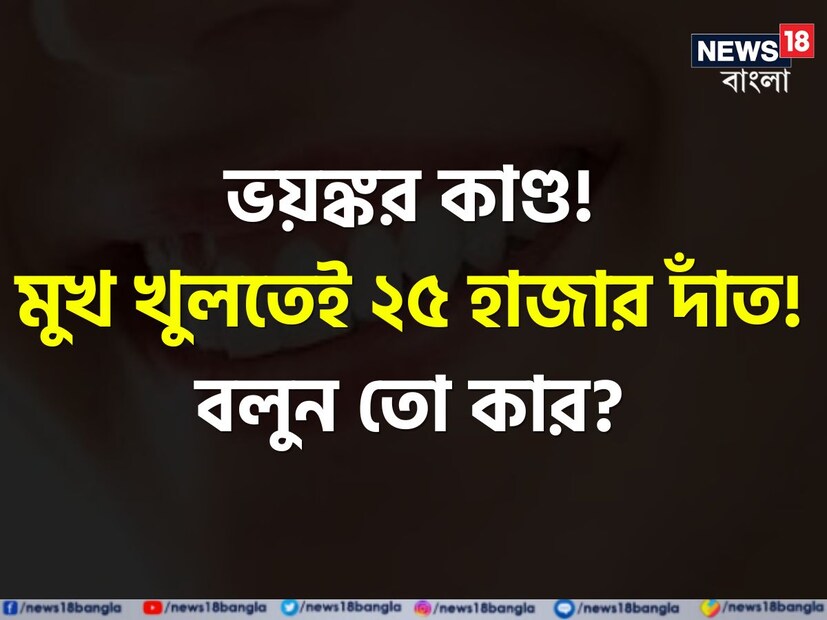 বলুন তো, এই বিশ্বে কার মোট ২৫ হাজার দাঁত রয়েছে? কী পড়েই আবাক হলেন? অবাক হলেও এই কথা সত্য়ি। আমাদের মানুষের যেমন ৩২টি দাঁত থাকে, ঠিক তেমনই এমন এক প্রাণী রয়েছে যার দাঁতের সংখ্যা ২৫০০০।