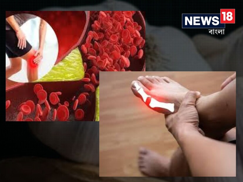 Disclaimer: এই খবরের মধ্যে দেওয়া ওষুধ/স্বাস্থ্য সম্পর্কিত পরামর্শ বিশেষজ্ঞদের সঙ্গে আলোচনা করে প্রাপ্ত। এটি সাধারণ তথ্য এবং ব্যক্তিগত পরামর্শ নয়। তাই ডাক্তারের পরামর্শ ছাড়া কোনও কিছু ব্যবহার না করার জন্য অনুরোধ করা হচ্ছে। নিউজ18 বাংলা কোনও ব্যবহারে ক্ষতির জন্য দায়ী থাকবে না।