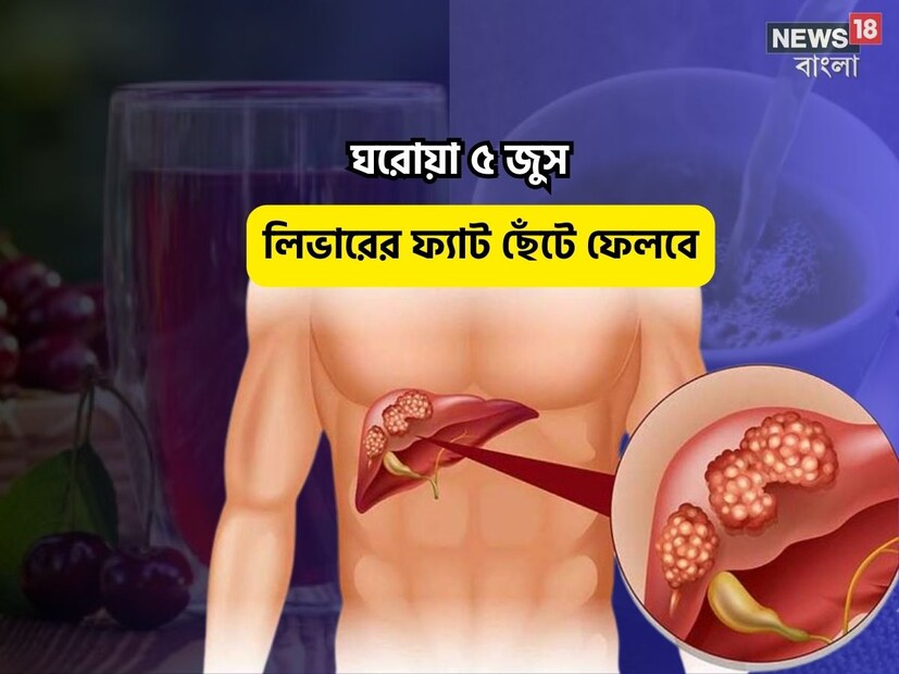 Disclamer: এই মতামত News18বাংলার নিজস্ব মত নয়৷ প্রচলিত ধারণার ভিত্তিতেই এই প্রতিবেদন৷ সঠিক ফল পেতে বিশেষজ্ঞের পরামর্শ নিন৷