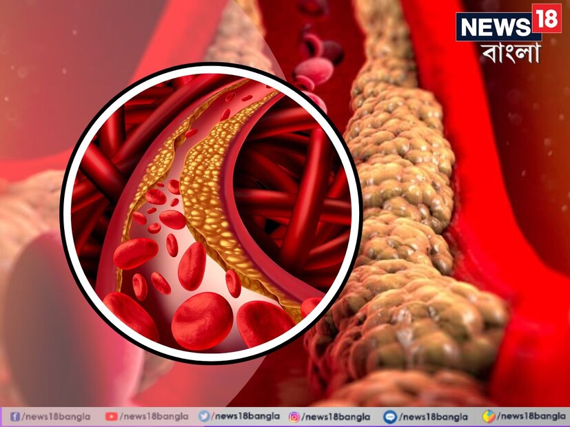 শীতের মরশুমে বাজার জুড়ে ছড়িয়ে আছে প্রচুর সবজি। এদের মধ&#x200d;্যে প্রত&#x200d;্যেকের উপকারিতা আলাদা আলাদা। তবে শীতের একটি সবজি বেশিরভাগ বাড়িতেই অবহেলিত। বাজারে দেখেও অনেকে কেনেন না এই সবজি। কিন্তু এটিই দেহের অন্দর থেকে টেনে বের করতে পারে কোলেস্টেরল। 