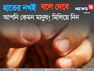 থ্যাবড়া না লম্বা? আঙুলের নখই বলে দেবে আপনি 'কেমন' মানুষ! মিলিয়ে দেখুন ছবিতে থ্যাবড়া না লম্বা? আঙুলের নখই বলে দেবে আপনি 'কেমন' মানুষ! মিলিয়ে দেখুন ছবিতে
