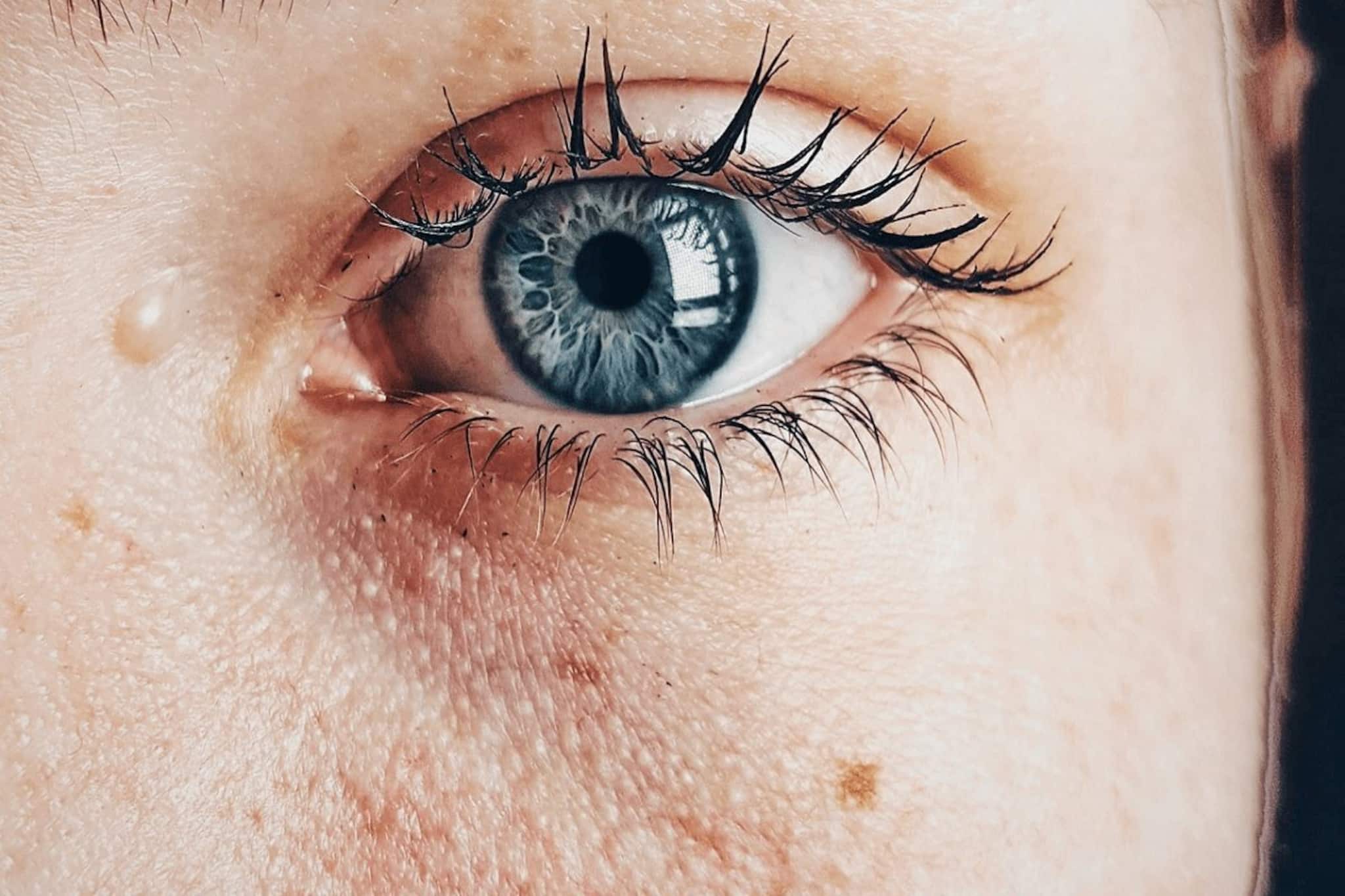 একটা কমছে-একটা উঠছে! শীতেও মুখে ভরে যাচ্ছে গোটা-ব্রণ-র‍্যাশ? রইল ম্যাজিক টিপস