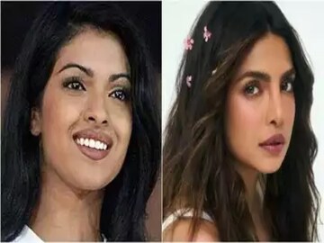 নাকের অস্ত্রোপচারে ভুল! 'অফার' পেতেন না প্রিয়াঙ্কা, যা করেছিলেন এই পরিচালক...!