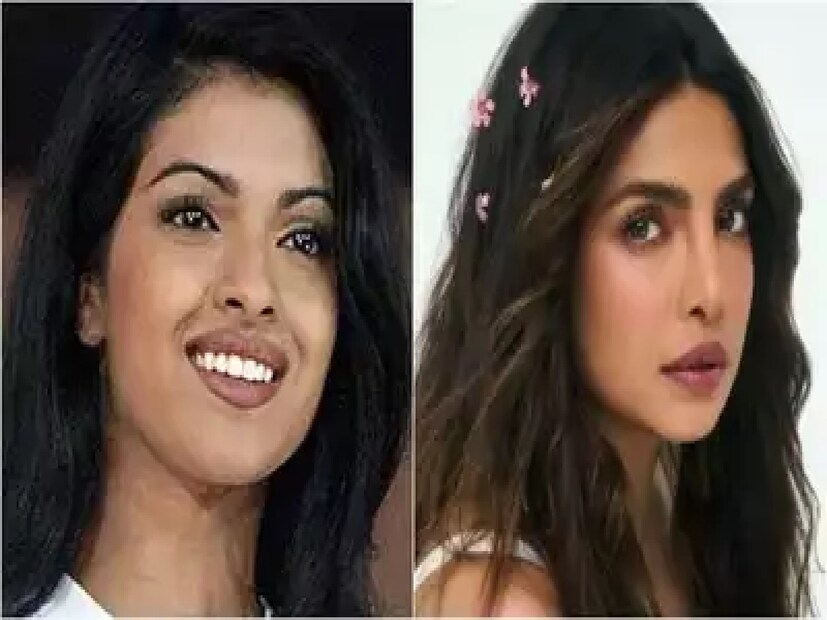 নাকের অস্ত্রোপচার করিয়েছিলেন বি-টাউনের সুন্দরী এবং প্রতিভাময়ী অভিনেত্রী প্রিয়াঙ্কা চোপড়া। কিন্তু দুর্ভাগ্যবশত তাঁর সেই নাকের অস্ত্রোপচার ঠিকঠাক হয়নি। যার জেরে একাধিক কাজ হাতছাড়া হয়েছিল অভিনেত্রীর। সেই সময় তাঁর সহায় হয়েছিলেন পরিচালক অনিল শর্মা। সম্প্রতি এমনটাই দাবি করলেন পরিচালক।