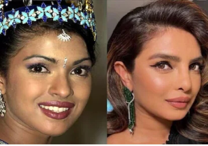  এই প্রসঙ্গে পরিচালক জানান যে, প্রিয়াঙ্কা ৫ লক্ষ টাকার টোকেন অ্যামাউন্ট ফেরত দিতে গিয়েছিলেন তাঁর কাছে। তবে ‘সিটাডেল’ অভিনেত্রীর নাকের অস্ত্রোপচারের আসল কারণ না জেনেই তাঁকে বকুনিও দেন।