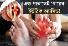 ইউরিক অ‍্যাসিডের সমস‍্যা? চিবিয়ে খান এই একটি পাতা, ম‍্যাজিকের মতো কমবে!