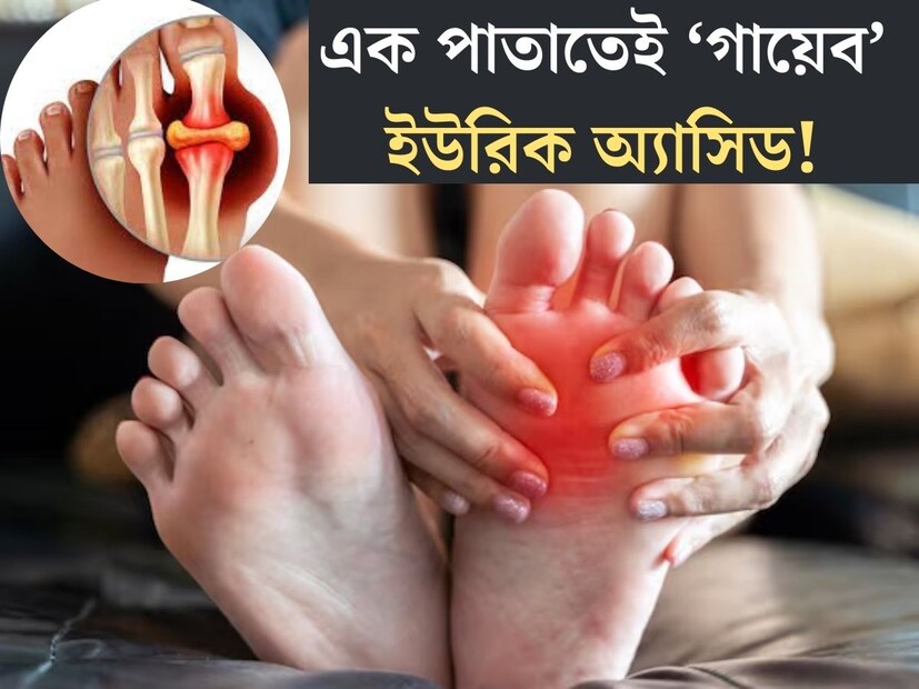 বদলে যাওয়া জীবনযাত্রা, ভুল খাদ&#x200d;্যাভ&#x200d;্যাস, ইউরিক অ&#x200d;্যাসিড বৃদ্ধির জন&#x200d;্য দায়ী একাধিক কারণ। তবে দিন দিন আরও বাড়ছে ইউরিক অ&#x200d;্যাসিড আক্রান্তের সংখ&#x200d;্যা। প্রচুর মানুষ ভুগছেন এই সমস&#x200d;্যায়। 