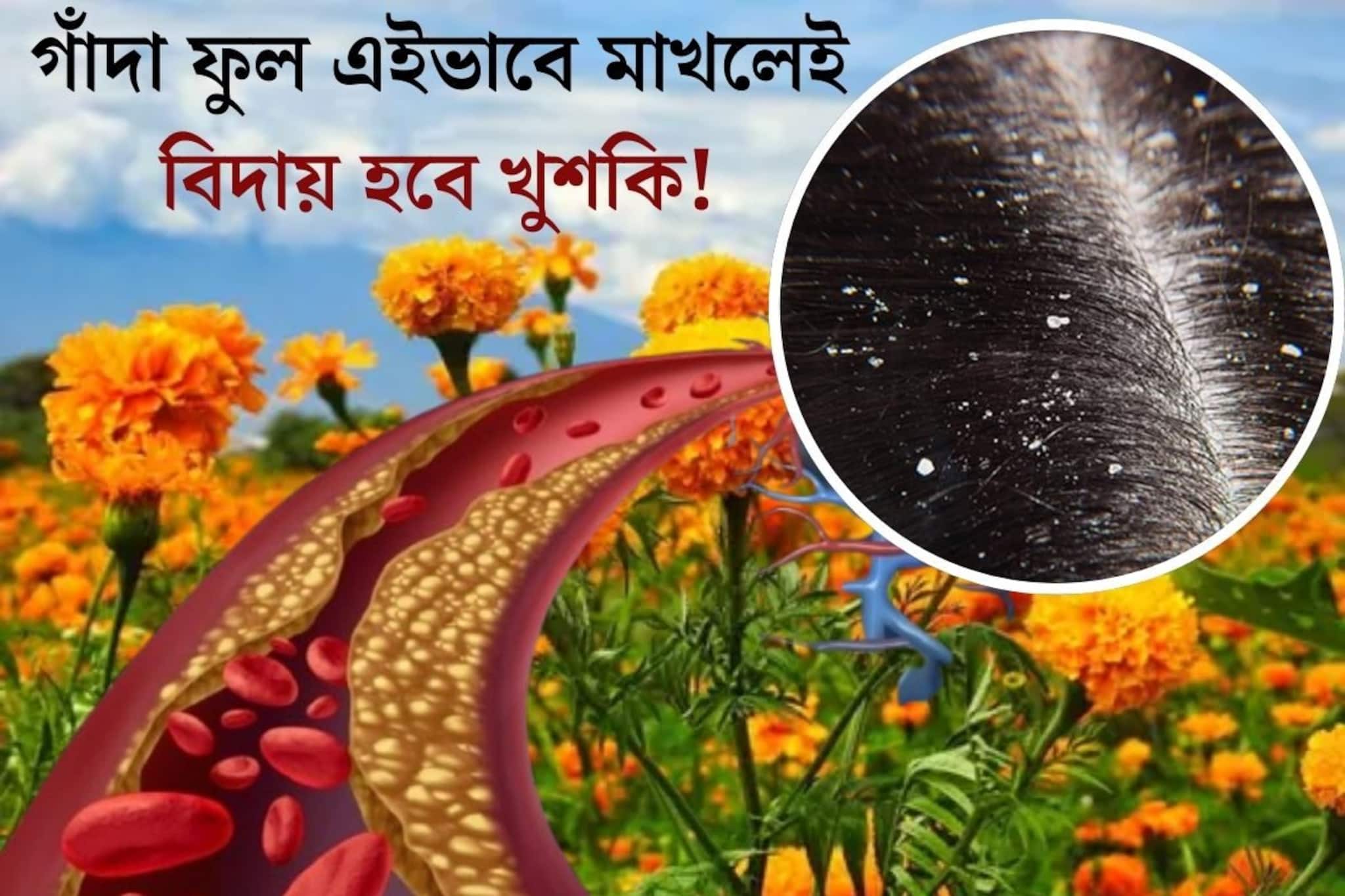 খুশকিতে মাথা সাদা? চুল পড়া, ত্বকের সমস‍্যা...গাঁদা ফুলই মহৌষধ, রক্ত থেকে ছেঁকে
