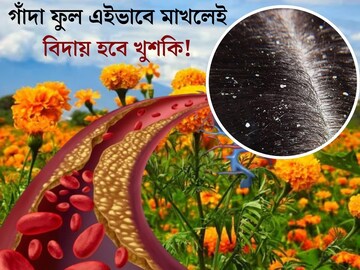 খুশকিতে মাথা সাদা? চুল পড়া, ত্বকের সমস‍্যা...গাঁদা ফুলই মহৌষধ, রক্ত থেকে ছেঁকে