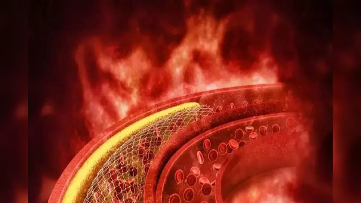 রান্নাঘরেই আছে এই ব্রহ্মাস্ত্র, রোজ খেলেই ম্যাজিক! হরহরিয়ে কমবে কোলেস্টেরল…