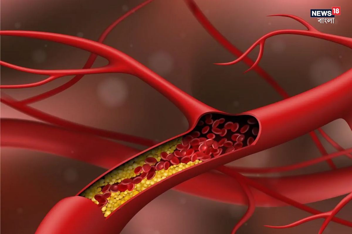 Cholesterol Control Tips: ১৫ দিনেই কোলেস্টেরলের মুখে ছাই! এক পানীয়তেই গলে গলে পড়বে চিপচিপে পদার্থ! হার্ট অ্যাটাকের চান্স জিরো