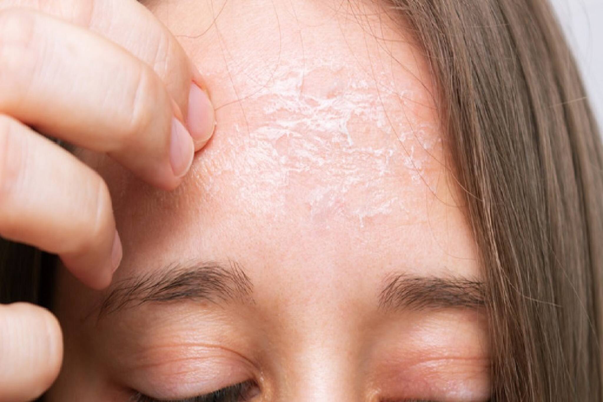 শীতে চামড়া শুকিয়ে খোসা উঠছে? ফুটিফাটা ত্বক বাঁচাবে ৪ টিপসে! গ্লো করবে গোটা শরীর