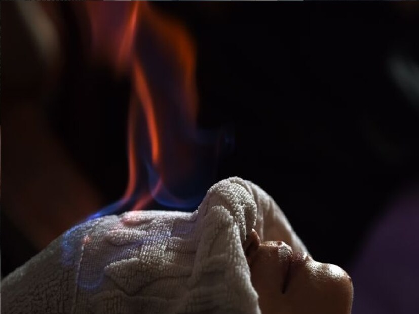 *অপারেশন করার পরেও অনেকেরই ব্যথা থেকে মুক্তি মেলে না। এই সমস্ত জটিল রোগের চিকিৎসা এবার নিমেষেই সম্ভব ব্যথা ছাড়াই। কোনওরকম ব্যথার ওষুধ বা অপারেশনের প্রয়োজন পড়বে না। শুধুমাত্র আয়ুর্বেদিক ‘অগ্নিকর্ম চিকিৎসা’ পদ্ধতিতে এই সমস্ত রোগ থেকে সহজেই নিরাময় সম্ভব। সংগৃহীত ছবি। 