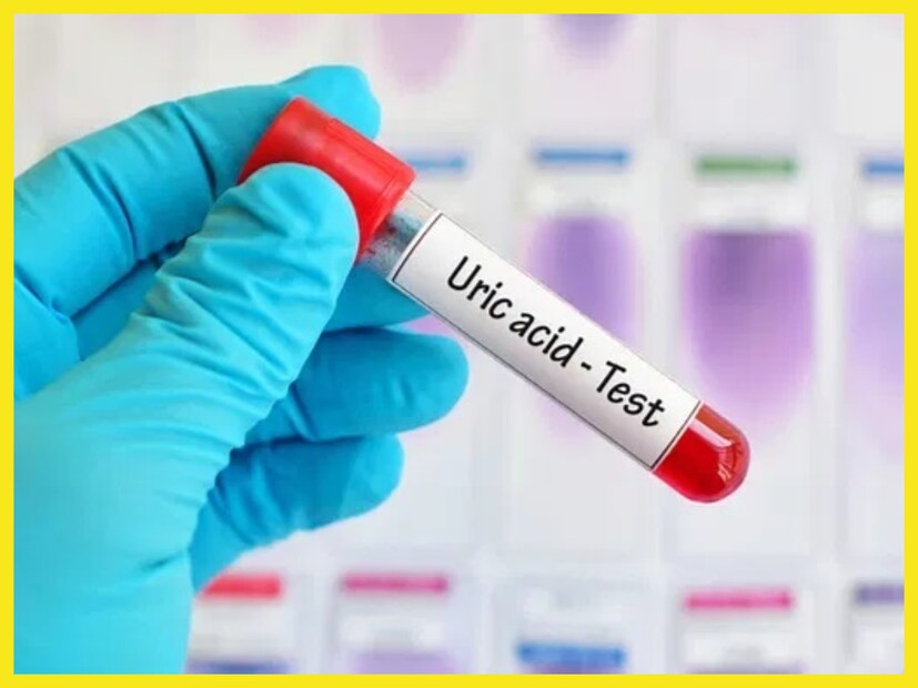 বেশ কিছু খাদ্যে পিউরিন পাওয়া যায় ৷ এছাড়াও অস্বাস্থ্যকর জীবন যাপন ৷ শারীরিক ক্রিয়া প্রক্রিয়ায় হঠীৎ করে সমস্যা বাড়তে শুরু করে দেয় ৷ প্রতীকী ছবি ৷