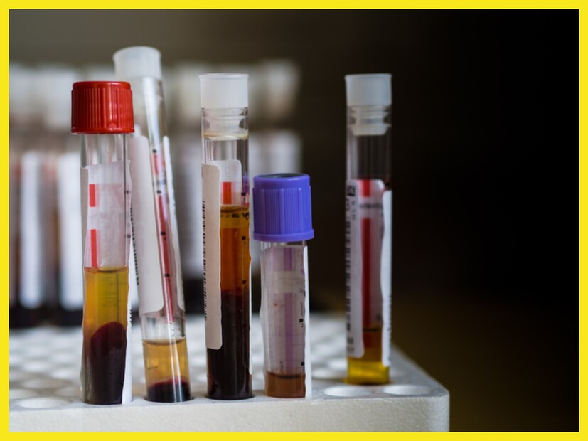 Disclaimer: উপরোক্ত বিষয়গুলি মানতে নিউজ ১৮ বাংলা বাধ্য বা অনুরোধ করেনা ৷ নিজের বিচার বুদ্ধি সহযোগে সিদ্ধান্ত নিন ৷ প্রতীকী ছবি ৷