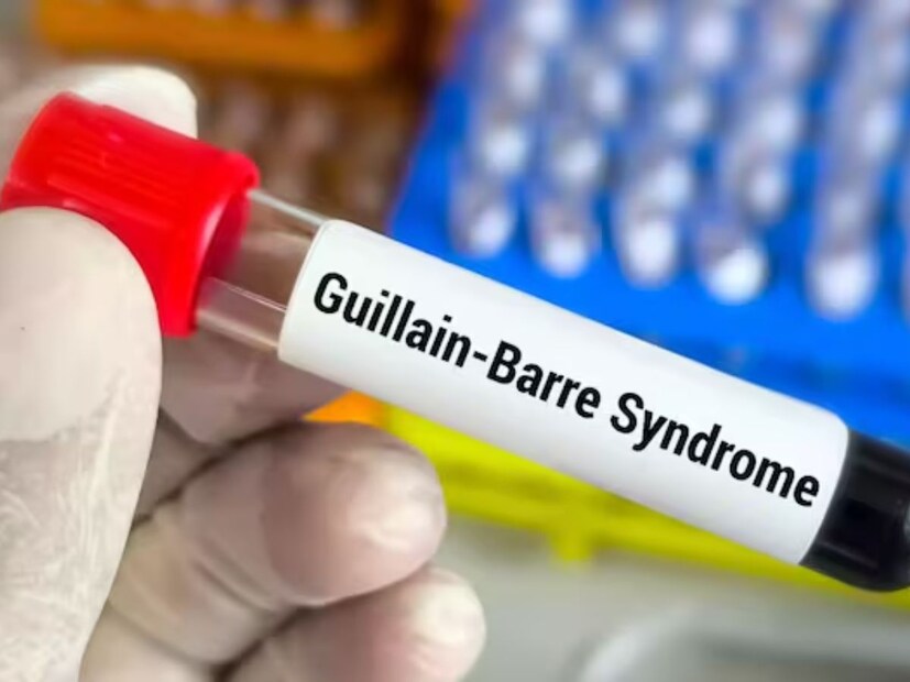 মৃত্যুর প্রাথমিক কারণ Gillian Barre Syndrome -জানা গিয়েছে যে মৃত রোগীর বয়স ৪০ বছর। সমবায় হাসপাতালে চিকিৎসাধীন অবস্থায় সংশ্লিষ্ট রোগীর মৃত্যু হয়। ছত্রপতি শিবাজি মহারাজ সর্বোপচার সরকারি হাসপাতালে দেহের ফরেনসিক মেডিকেল পরীক্ষা করা হয়। সংশ্লিষ্ট হাসপাতালের দেওয়া চিকিৎসার নথিপত্র দেখে জানা গিয়েছে মৃত্যুর প্রাথমিক কারণ Gillian Barre Syndrome।
