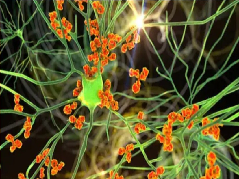 *যদিও মৃতের পরিবার মনে করছে তেমন কিছু নয়। হুগলি জেলা মুখ্য স্বাস্থ্য আধিকারিক জানিয়েছেন ঠিক কীকারণে মৃত্যু তা পরীক্ষা না করে বলা মুশকিল। চিকিৎসক শুভ্র ভট্টাচার্য জানান, যখন অসুস্থ হয়ে আসেন তখন দেখি তার হাত, পা অসাড়। সংগৃহীত ছবি। 