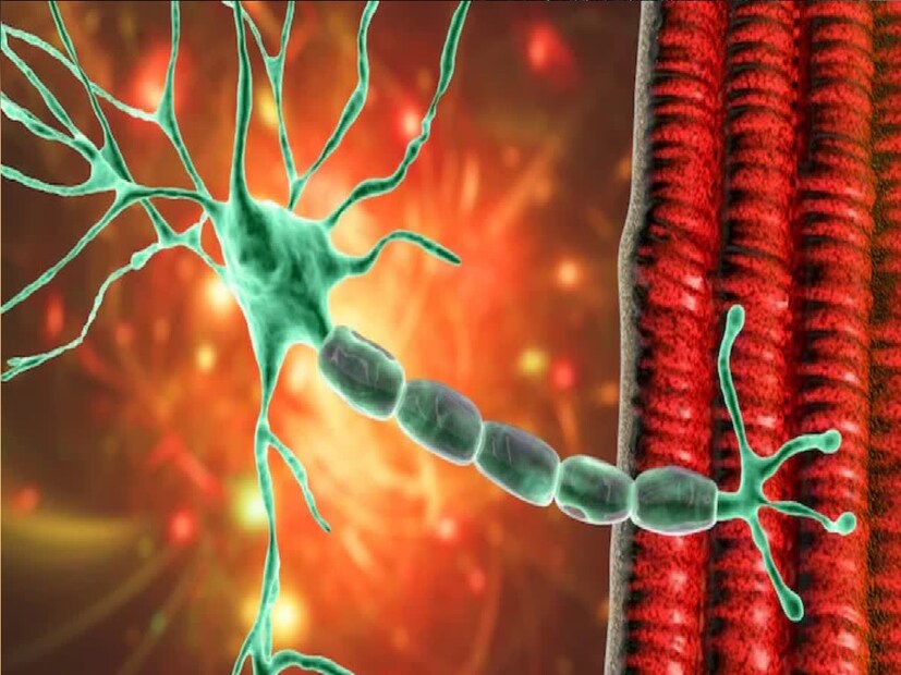 *হাসপাতালে নিয়ে যাওয়ার পর চিকিৎসা শুরু হলেও বাঁচানো যায়নি। হুগলি জেলা মুখ্য স্বাস্থ্য আধিকারীক মৃগাঙ্ক মৌলি কর জানান,পরীক্ষা না হলে বলা সম্ভব না গুলেন বারি হয়েছিল কিনা। জ্বর শ্বাসকষ্ট হাত-পা অসাড় হয়ে যাওয়া গুলেন বারি উপসর্গ হতে পারে। সংগৃহীত ছবি।