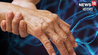 গুলেইন বারির উপসর্গ কী কী? গুলেইন বারির উপসর্গ কী কী?