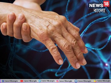 গুলেইন বারির উপসর্গ কী কী? 