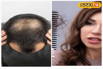 কোনও স্পা নয়, হেয়ার কেয়ার হবে পথের ধারের এই আগাছায়, পার্লারে টাকা খরচ ছাড়াই কোনও স্পা নয়, হেয়ার কেয়ার হবে পথের ধারের এই আগাছায়, পার্লারে টাকা খরচ ছাড়াই